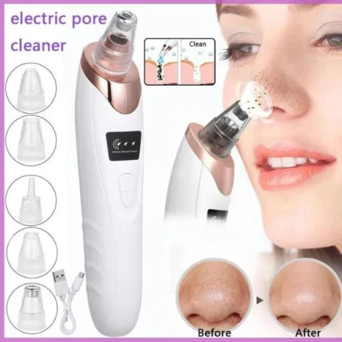 5 in 1 Rechargeable Blackhead Remover
